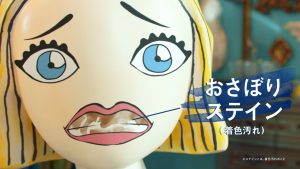 マスクの下の“おさぼりステイン”をやっつけろ！ 永野芽郁出演のオーラツー最新 TVCM4月30日(土)から放送開始！