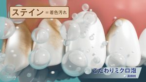 マスクの下の“おさぼりステイン”をやっつけろ！ 永野芽郁出演のオーラツー最新 TVCM4月30日(土)から放送開始！